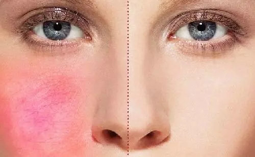 敏感肌肤用什么护肤品?教你敏感肌正确的护肤步骤