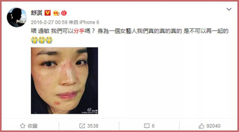 敏感肌肤用什么护肤品?教你敏感肌正确的护肤步骤