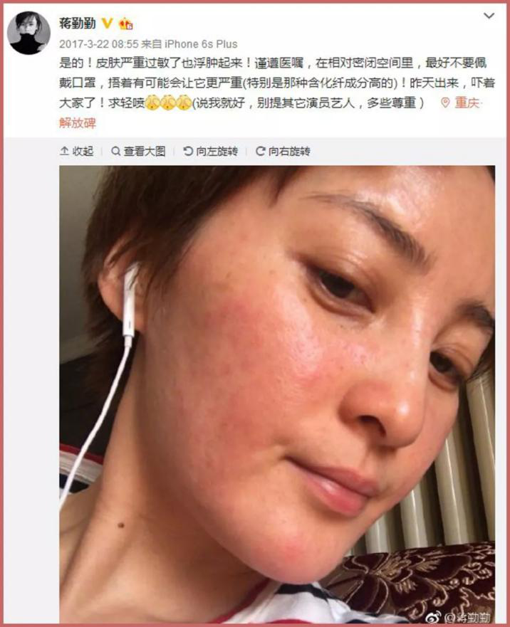 敏感肌肤用什么护肤品?教你敏感肌正确的护肤步骤