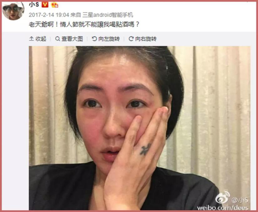 敏感肌肤用什么护肤品?教你敏感肌正确的护肤步骤